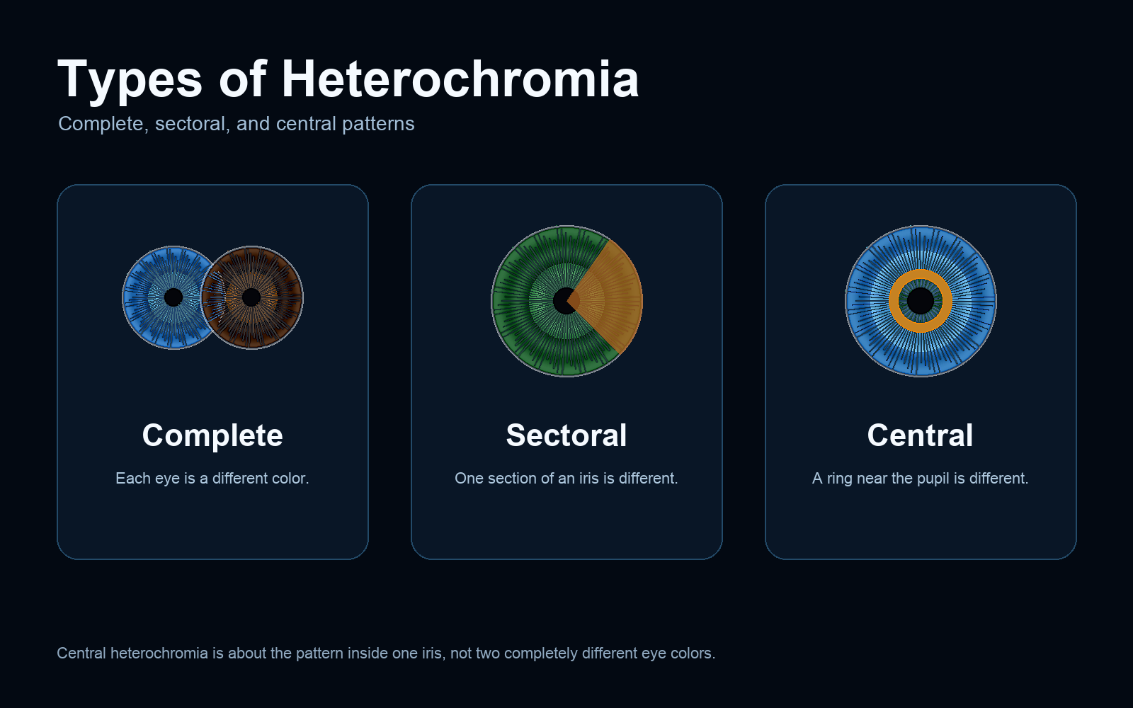 Types of heterochromia chart showing complete, sectoral and central heterochromia patterns